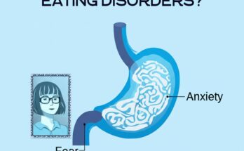 Eating Disorder Help What Are Eating Disorders?